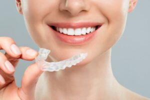 INVISALIGN